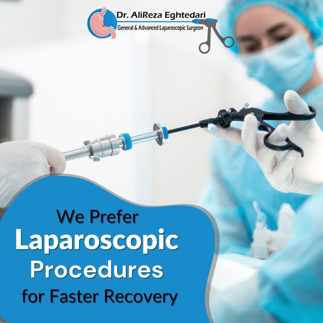 Advantages of Laparoscopic Hernia Surgery in Dubai with Dr Alireza Eghtadari